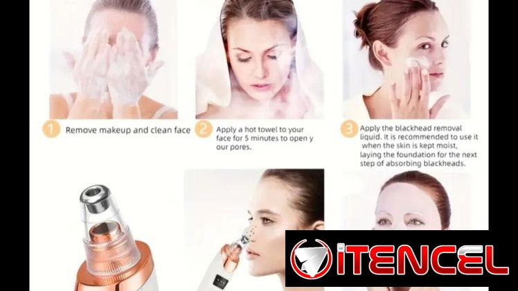 Limpiador facial recargable, extractor de puntos negros, succionador de espinillas.
