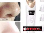 Limpiador facial recargable, extractor de puntos negros, succionador de espinillas.