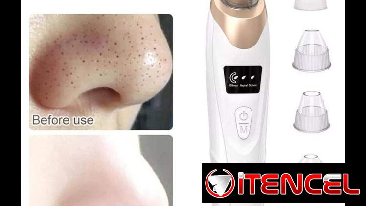 Limpiador facial recargable, extractor de puntos negros, succionador de espinillas.