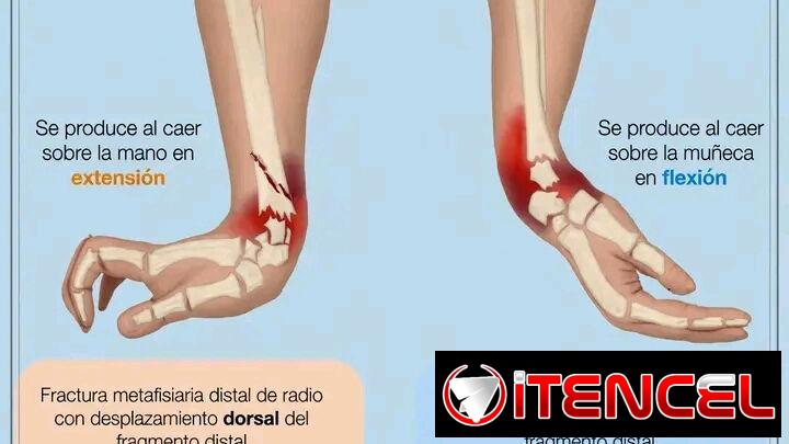 Fisioterapeuta