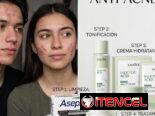 Acné y belleza