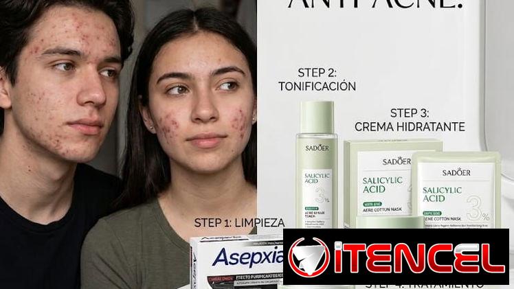 Acné y belleza