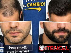 102f7ec61a6de329fdf2773cb5cebfcfa1ff47d93e325fe743445a3ed639d466