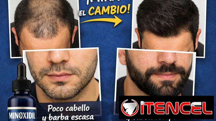 💪 Minoxidil East Moon – Caja de 3 frascos (60 ML c/u)   ✨ Resultados visibles en pocas semanas   💰 Precio: 20 USD   📦