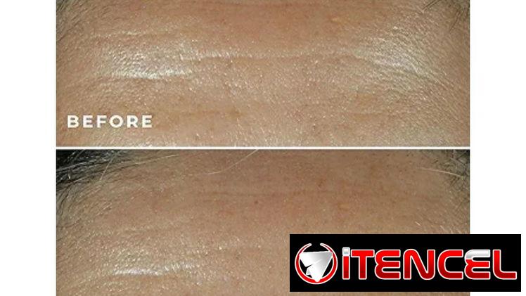 RoC Retinol Correxion Deep Wrinkle Filler (30 ml) | videojuegoshabana.com