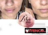 Mascarilla facial Lumi Radiance de la marca Turca FARMASI