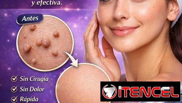 Eliminación de verrugas y lesiones benignas
