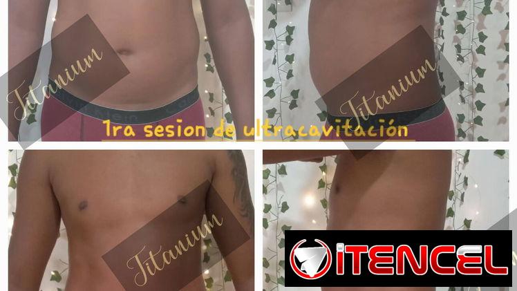 Eliminar grasa abdominal, quemador de grasa, eliminar flacidez, maderoterapia , masajes, grasa, bajar de peso