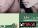 🍃 JABÓN TEA TREE FARMASI (ORGÁNICO) – CONTROL ACNÉ Y GRASA 🍃
