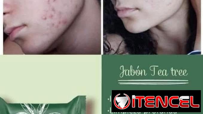 🍃 JABÓN TEA TREE FARMASI (ORGÁNICO) – CONTROL ACNÉ Y GRASA 🍃