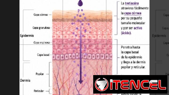 TRETINOINA SOY DE LA LISA