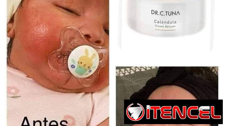 Crema de Caléndula de la marca Turca Farmasi cicatrizante, elimina manchas y marcas en la piel