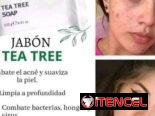 🍃 JABÓN TEA TREE FARMASI (ORGÁNICO) – CONTROL ACNÉ Y GRASA 🍃