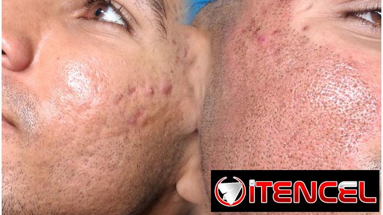 🔥 ¡CAMBIA TU ROSTRO, ELEVA TU BELLEZA HOY! 🔥 ¿Lista para verte más joven, radiante y segura desde la primera sesión?