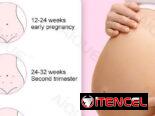 Doppler Fetal. PRIMERA MANO