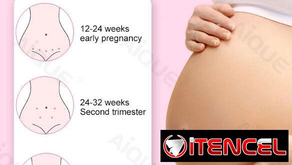 Doppler Fetal. PRIMERA MANO