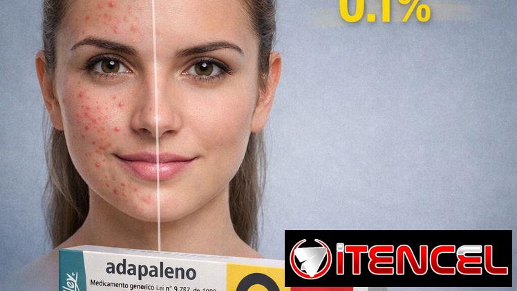 Adapaleno 0.1 % Tubo de 30g (Tratamiento del acné)