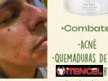 ¡Bálsamo Tea Tree de Dr. C. Tuna by Farmasi! 🌿✨