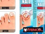 CREMA PREVENTIVA PARA  UÑAS CON ONICOMICOSIS 1900$