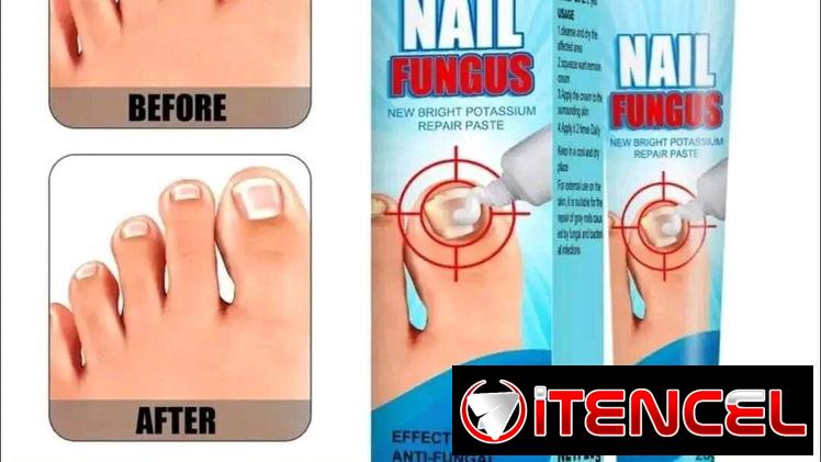 CREMA PREVENTIVA PARA  UÑAS CON ONICOMICOSIS 1900$