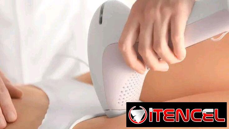 Depilación laser ipl