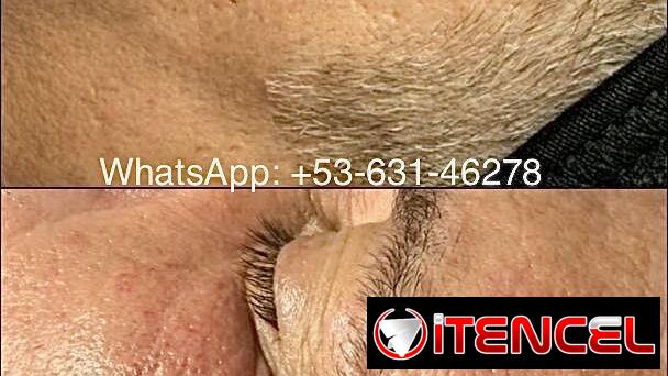 Tratamientos faciales y corporales