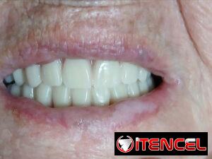 95b22a7df12af204046d117c997abaf2095178b21f25d33655b1dea1296b5bc8