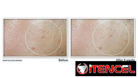 RoC Multi Correxion Even Tone + Lift Daily Moisturizer con SPF 30 (50 ml) | videojuegoshabana.com