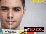 Gel de Adapaleno 0.1 % para el acné