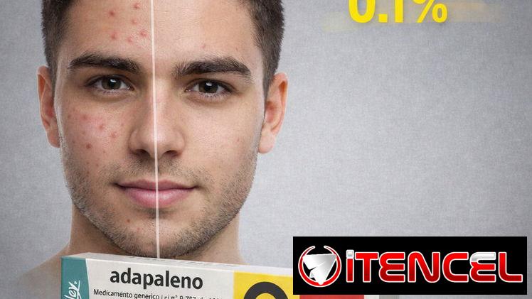 Gel de Adapaleno 0.1 % para el acné