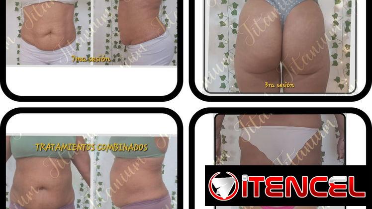 Eliminar flacidez, quemar grasa, tonificación de músculos, eliminar grasa , desinflamación, masajes reductores, grasa