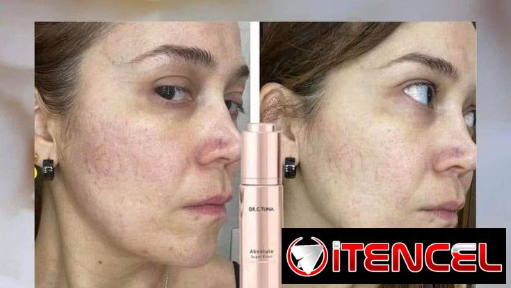 Elixir Supremo Absoluto
