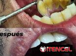 No se lo pierda , servicio de estética dental