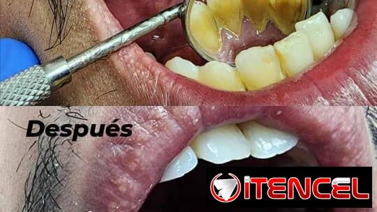 No se lo pierda , servicio de estética dental