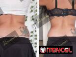 Eliminar grasa abdominal, quemador de grasa, eliminar flacidez, maderoterapia , masajes, grasa, bajar de peso