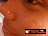 Perforaciones nariz, orejas a bebés y adultos con aretes Antialérgicos medicinales