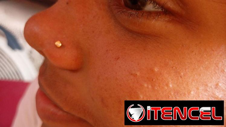 Perforaciones nariz, orejas a bebés y adultos con aretes Antialérgicos medicinales