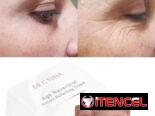 Botox instantáneo Farmasi