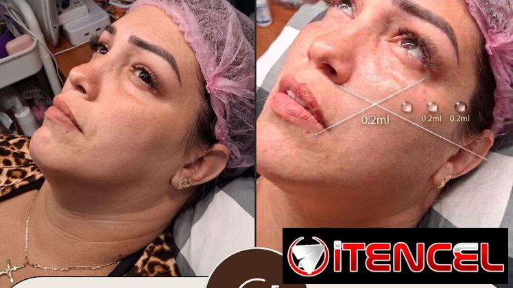 🔥 ¡CAMBIA TU ROSTRO, ELEVA TU BELLEZA HOY! 🔥 ¿Lista para verte más joven, radiante y segura desde la primera sesión?