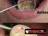 No se lo pierda , servicio de estética dental