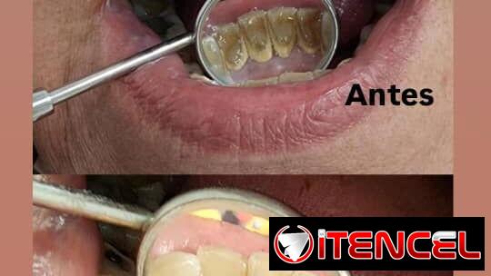 No se lo pierda , servicio de estética dental
