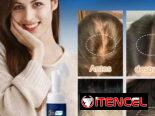 Minoxidil para prevenir la caída del cabello, estimula el crecimiento.