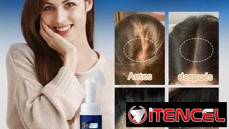 Minoxidil para prevenir la caída del cabello, estimula el crecimiento.