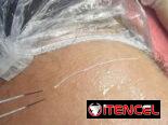 🌿Limpieza facial profunda 🌿 Limpieza profunda de espalda 🌿 Dermapen / Microneedling 🌿 Hidralips Gloss