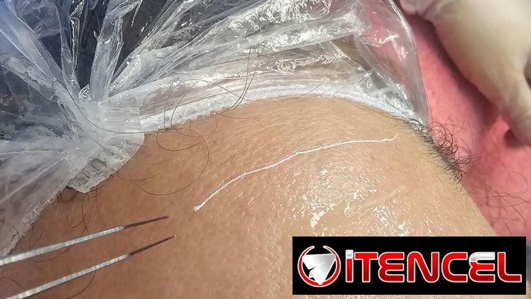 🌿Limpieza facial profunda 🌿 Limpieza profunda de espalda 🌿 Dermapen / Microneedling 🌿 Hidralips Gloss