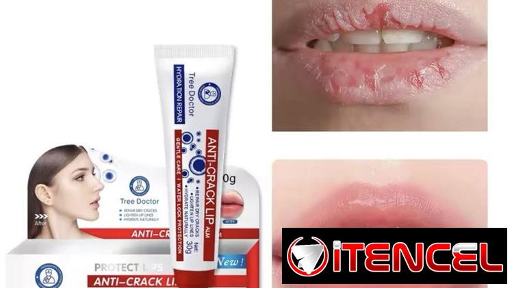 Bálsamo o Crema Extra Hidratante para labios agrietados pomada para el alivio de la resequedad y grietas en los labios