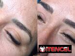 🔥 ¡CAMBIA TU ROSTRO, ELEVA TU BELLEZA HOY! 🔥 ¿Lista para verte más joven, radiante y segura desde la primera sesión?