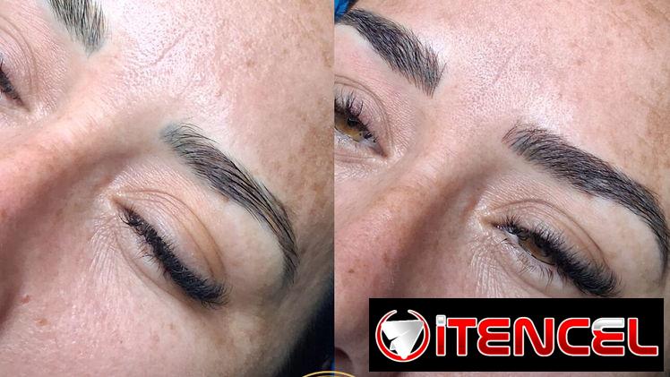 🔥 ¡CAMBIA TU ROSTRO, ELEVA TU BELLEZA HOY! 🔥 ¿Lista para verte más joven, radiante y segura desde la primera sesión?