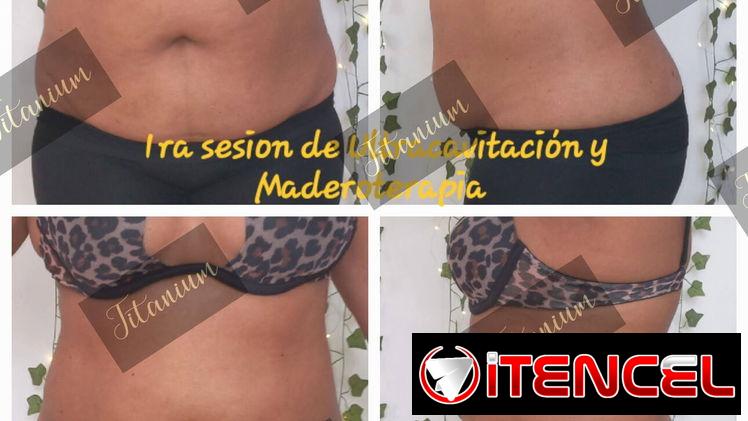 Eliminar grasa abdominal, quemador de grasa, eliminar flacidez, maderoterapia , masajes, grasa, bajar de peso