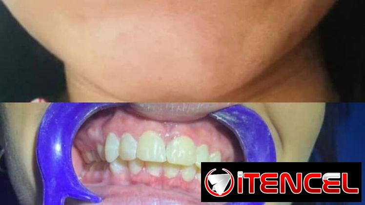 Diseño sonrisa